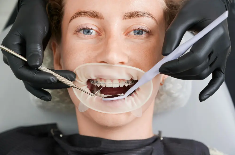 Orthodontics-thumbnail